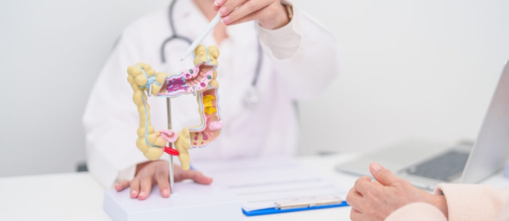 sindrome intestino irritabile santagostino bologna