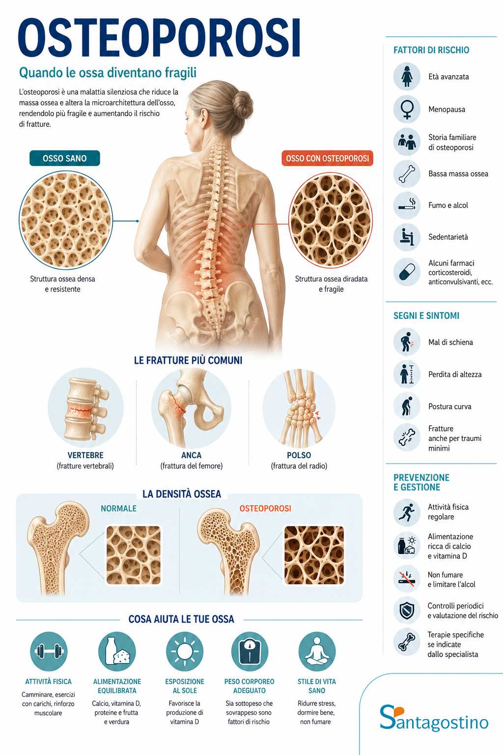 infografica osteoporosi