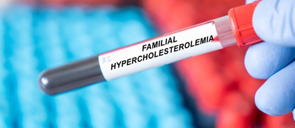 ipercolesterolemia bologna